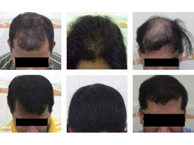 Radiance Hair Clinics - Hair transplant clinic in Bhubaneswar - A  Professional Business Directory | India Business Directory