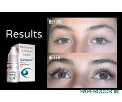 Careprost For Eyelashes Growth | Genericaura
