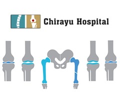 Orthopedic Surgeon Hospital in Ahmedabad, Gujarat, India - Chirayu Hospital