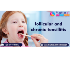 Follicular and chronic tonsillitis treatment in Hyderabad